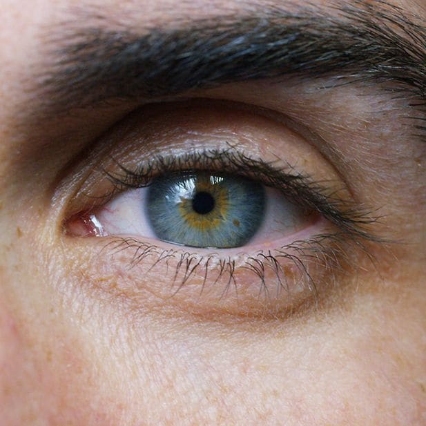 Effects_of_roaccutane_row_8