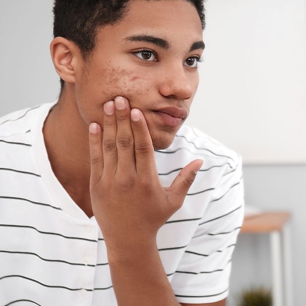 Effects_of_roaccutane_row_3